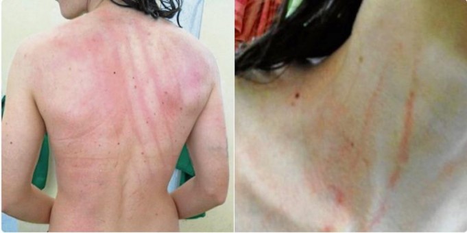 Απίστευτος ξυλοδαρμός παικτριών σε γυναικείο ματς στην Ισπανία